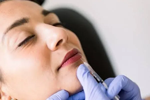 Aplicação de preenchedor facial